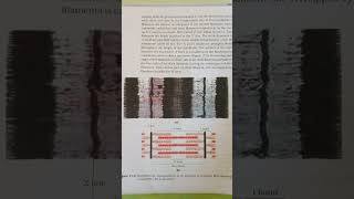 Locomotion and movement figure 172a anatomy of muscle fibres showing sarcomere b sarcomere🙏 [upl. by Curr437]