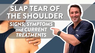 SLAP tear of the shoulder Signs symptoms and current treatments [upl. by Zosema]