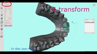 A video 2mn about meshmixer  ADDING A TOOTH [upl. by Chaffinch]