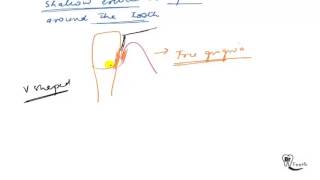 Anatomy of gingiva Part1 [upl. by Simpkins]