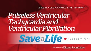 7b Pulseless Ventricular Tachycardia and Ventricular Fibrillation 2024 [upl. by Verada]