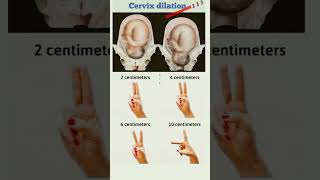 🤰🤰 Dilation of cervix 🤰🤰👩‍⚕️👩‍⚕️ [upl. by Thea]