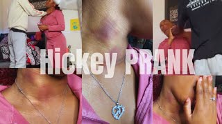 Hickey Prank On My Protective boyfriend got heated [upl. by Florida270]