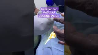 Injection for MACULAR DEGENERATION maculardegeneration [upl. by Kussell451]