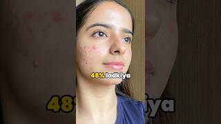 Pimples hote hai makeup lagana se youtubeshorts [upl. by Ydnik242]