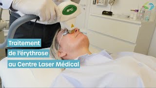 Avant et Après  Vaincre la Rosacée avec le MaxG lumière pulsée vasculaire chez Nutriesthétic Liège [upl. by Oler]