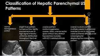 Liver Ultrasound Diffuse Disease Cirrhosis  fibrosis  Scoring  Hepatitis  Autoimmune  Contra [upl. by Ahsenre]