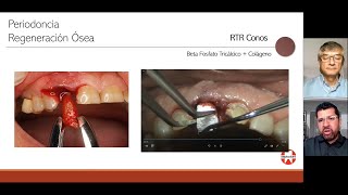 RTR Septodont Charlas con Hermes Depósito Dental Laguna SA de CV [upl. by Aihtyc]