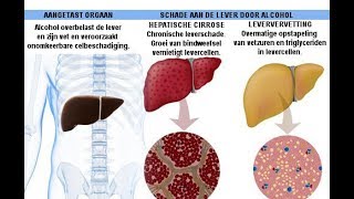 Gevolgen van alcohol [upl. by Eloisa]