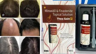 Thea Gain Minoxidil and Finasteride Topical Solution [upl. by Nnaeitak634]