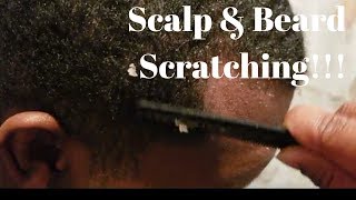 One week of Scratching Compilation Beard and Scalp Dandruff [upl. by Urd532]