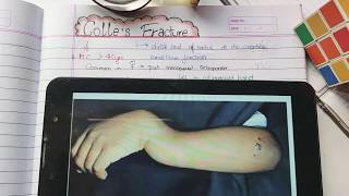 Colles fracture theory exam notes with explanation [upl. by Refinney]