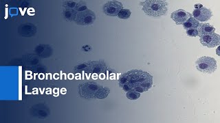 Bronchoalveolar Lavage BAL  Obtaining Adequate Sample Yield [upl. by Ysabel]