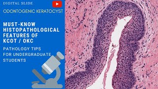 Odontogenic Keratocyst Histopathology [upl. by Xavier415]