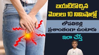 Home Remedies for Piles  Get Rid of Hemorrhoids  Pain Relief  Manthenas Health Tips [upl. by Ribble232]