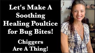 Lets Make A Soothing Healing Poultice for Bug Bites Chiggers are a thing [upl. by Lamag]