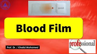 Blood Film أسرع وأسهل طريقة لعمل [upl. by Naletak]