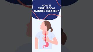 Esophagus cancer treatment in Delhi Noida DrAshishSachan [upl. by Quirk]