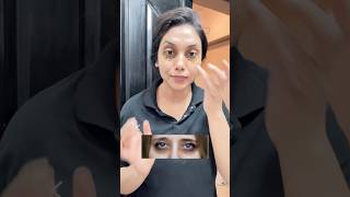 Remove Dark circles and eye puffiness in just 7days💯 [upl. by Garvy]