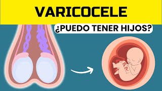 VARICOCELE puede causar INFERTILIDAD MASCULINA [upl. by Coster171]