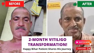 2Month Vitiligo Transformation  Happy Bihar Patient Shares His Journey  vitiligotreatment [upl. by Yorle187]