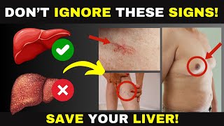 Top Warning Signs Your Liver Are Dying [upl. by Ludlow510]