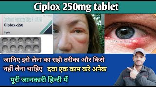 Ciplox 250 tablet use dose benefits and Side effects full review in hindi [upl. by Norrad]