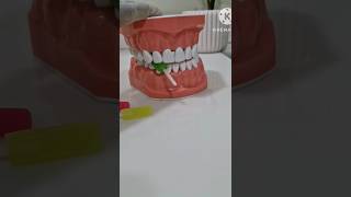 Aligners fit ആവാൻ ഇതുമതി  pallil kambi idunnath  viral  shorts  malayalam braces  dentist [upl. by Ahsyle]