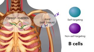 Chronic bacterial infection activates autoreactive B cells [upl. by Tolman247]