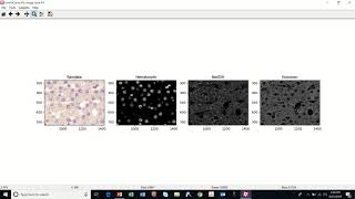 Chromogenic Assay CellProfiler Demo [upl. by Ardnik608]