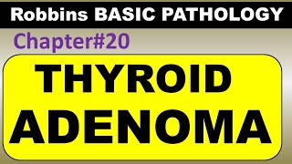 Ch20  Thyroid Adenoma  Endocrine Pathology Robbins Pathology  Dr Asif Lectures [upl. by Abbot583]