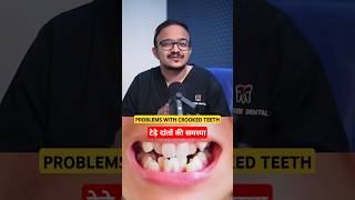 Crooked teeth can be much bad suratdentist dentist smiledentist [upl. by Vange]