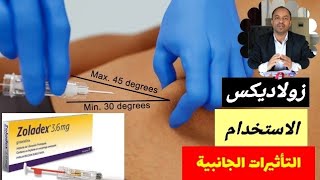 ابرة زولادكس zoladex  الجرعة والاستخدام والاعراض الجانبية [upl. by Cynar]