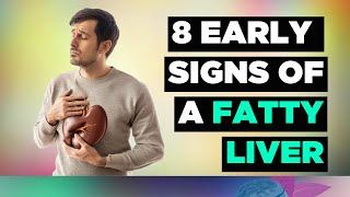 8 Signs You Have A FATTY LIVER [upl. by Rafaelof698]