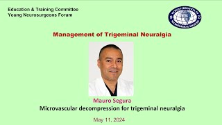 Microvascular decompression for trigeminal neuralgia Mauro Segura [upl. by Innos]