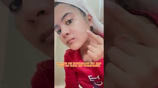 HOW TO USE LUXE ORGANIX HYDROCOLLOID ACNE PATCH🤍🫶angge budolniangge luxeorganix [upl. by Coster]