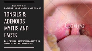 TONSIL AND ADENOID SURGERY MYTHS AND FACTS I TAMIL VERSION I PART 1 [upl. by Kirsti328]