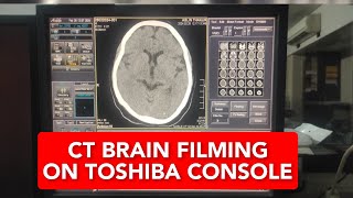 CT Brain filming on console of 16 slice toshiba [upl. by Eniron]