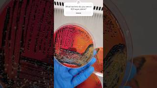 Bacteria on XLD Agar Plate shorts microbiology chemistry laboratory [upl. by Calabresi]