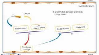 Sepsis development and progression [upl. by Irving52]