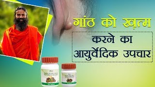 Ayurvedic Treatment for Lipoma गांठ  Swami Ramdev [upl. by Stockmon390]