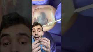 Hematoma subungueal curiosidades sabiasque [upl. by Tufts203]