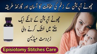 Chota Operation Recovery In Urdu  सामान्य प्रसव के टांके की घर पर देखभाल  Episiotomy Stitches Care [upl. by Nylitak]