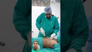 Gynecomastia Surgery 😳🩺 dezireplasticsurgerycenter plasticsurgerycenter doctor shortsfeed [upl. by Gernhard]