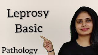 Leprosy in hindi  Leprosy pathology in hindi [upl. by Llemij]