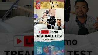 Live Treadmill Test heart treadmill hearthealth shorts short shortvideos drkrishvaidya [upl. by Lebasiram]