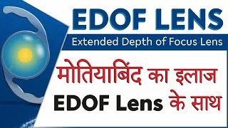 EDOF Lens for Cataract Patients  EDOF intraocular Lens  Best IOL lens choice [upl. by Tem]