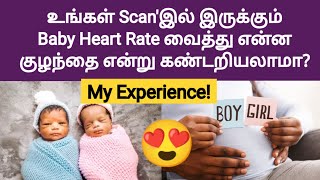 pregnancy baby heart rate boy or girl in tamil  boy or girl symptoms in pregnancy tamil  boy baby [upl. by Esyla]