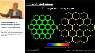 Prone position in ARDS L Gattinoni 2005 Strasburg 23 [upl. by Auhoj989]