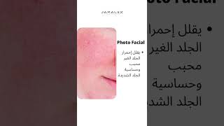 Photofacial or yellow laser jamalek skincare العنايهبالبشرة [upl. by Asante907]